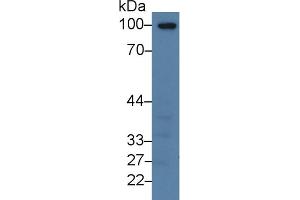 Western Blot; Sample: Human Lung lysate; Primary Ab: 3µg/ml Rabbit Anti-Human TM Antibody Second Ab: 0. (Thrombomodulin Antikörper  (AA 31-169))