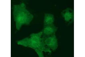 Anti-MOBKL2B mouse monoclonal antibody (ABIN2453314) immunofluorescent staining of COS7 cells transiently transfected by pCMV6-ENTRY MOBKL2B (RC205977). (MOBKL2B Antikörper)