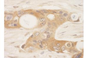 anti-serine threonine Kinase 39 (STK39) (AA 425-450) antibody