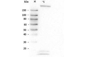 Western Blot of Rabbit anti-Robo-1 antibody. (ROBO1 Antikörper  (AA 1632-1644))