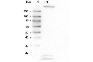 ROBO1 antibody  (AA 1632-1644)