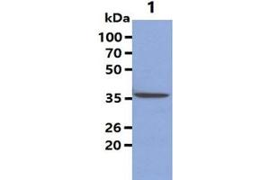 The Cell lysates (40ug) were resolved by SDS-PAGE, transferred to PVDF membrane and probed with anti-human Maspin antibody (1:1000). (SERPINB5 Antikörper)