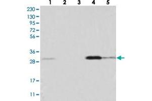 Western blot analysis of Lane 1: RT-4, Lane 2: U-251 MG, Lane 3: Human Plasma, Lane 4: Liver, Lane 5: Tonsil with WDR33 polyclonal antibody . (WDR33 Antikörper)