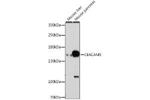 Western blot analysis of extracts of various cell lines, using CEACAM5 antibody. (CEACAM5 Antikörper)
