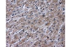 Immunohistochemical staining of paraffin-embedded liver tissue using anti-KIAA1609 mouse monoclonal antibody. (KIAA1609 Antikörper)