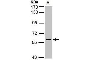 Western Blot using AP22398PU-N MAPK4 antibody at 1/1000 dilution: Sample (30 µg whole cell lysate) A: H1299 7. (MAPK4 Antikörper  (N-Term))