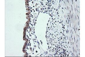 Image no. 2 for anti-V-Ets Erythroblastosis Virus E26 Oncogene Homolog 2 (ETS2) (AA 90-349) antibody (ABIN1491702) (ETS2 Antikörper  (AA 90-349))