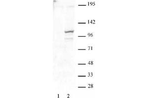 STAT2 phospho Tyr689 pAb tested by Western blot. (STAT2 Antikörper  (pTyr689))