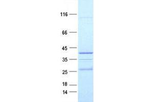 Western Blotting (WB) image for Neuregulin 4 (NRG4) protein (GST tag,His tag) (ABIN5505733)