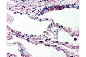 Immunohistochemistry (IHC) image for anti-Complement Component 5a Receptor 1 (C5AR1) antibody (ABIN2470782) (C5AR1 Antikörper)