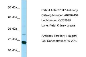 Western Blotting (WB) image for anti-Ribosomal Protein S17 (RPS17) (C-Term) antibody (ABIN2789846) (RPS17 Antikörper  (C-Term))