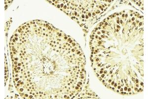ABIN6269183 at 1/100 staining Mouse testis tissue by IHC-P. (ELK1 Antikörper  (C-Term))