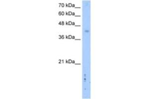Western Blotting (WB) image for anti-Leucine Rich Repeat Containing 2 (LRRC2) antibody (ABIN2462610)
