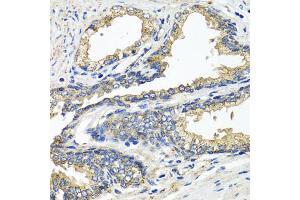 Immunohistochemistry of paraffin-embedded human prostate using ETFA antibody (ABIN5975750) at dilution of 1/100 (40x lens). (ETFA Antikörper)