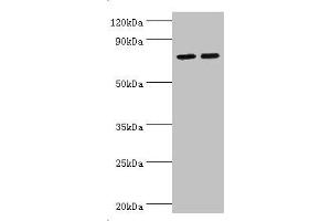 Western blot All lanes: Arachidonate 15-lipoxygenase B antibody at 11 μg/mL Lane 1: MCF-7 whole cell lysate Lane 2: 293T whole cell lysate Secondary Goat polyclonal to rabbit IgG at 1/10000 dilution Predicted band size: 76, 68, 70, 73 kDa Observed band size: 76 kDa (ALOX15B Antikörper  (AA 1-200))
