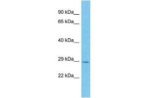 Western Blotting (WB) image for anti-MOB1, Mps One Binder Kinase Activator-Like 2C (MOBKL2C) (Middle Region) antibody (ABIN2791664)