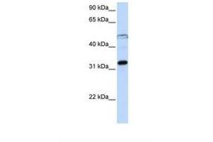 Image no. 1 for anti-Eukaryotic Translation Initiation Factor 3, Subunit G (EIF3G) (AA 218-267) antibody (ABIN6737929)