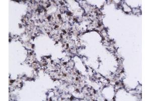 Formalin-fixed and paraffin embedded mouse lung tissue labeled with Anti- IL-5 Polyclonal Antibody, Unconjugated (ABIN674904) followed by conjugation to the secondary antibody and DAB staining (IL-5 Antikörper  (AA 56-132))
