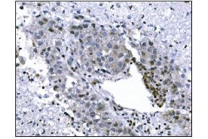 IHC analysis of KMT1B/SUV39H2 using anti-KMT1B/SUV39H2 antibody (ABIN7602135). (SUV39H2 Antikörper  (AA 6-410))