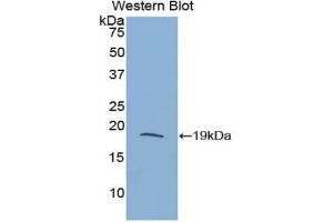 Detection of Recombinant RNASE3, Rat using Polyclonal Antibody to Ribonuclease A3 (RNASE3) (RNASE3 Antikörper  (AA 33-155))