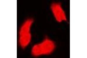 Immunofluorescent analysis of PSMB9 staining in MCF7 cells. (PSMB9 Antikörper)