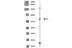 anti-Meis Homeobox 2 (MEIS2) (C-Term) antibody