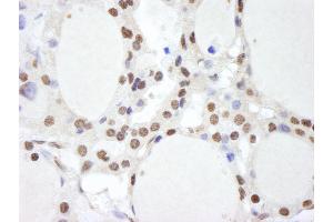 anti-Casein beta (CSN2) (AA 1-50) antibody