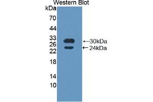 Western blot analysis of recombinant Human BMX. (BMX Antikörper  (AA 287-523))