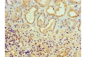 Immunohistochemistry of paraffin-embedded human kidney tissue using ABIN7150218 at dilution of 1:100 (ALKBH2 Antikörper  (AA 1-261))