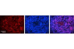 Rabbit Anti-PAntibody   Formalin Fixed Paraffin Embedded Tissue: Human Lymph Node Tissue Observed Staining: Nucleus Primary Antibody Concentration: 1:100 Other Working Concentrations: N/A Secondary Antibody: Donkey anti-Rabbit-Cy3 Secondary Antibody Concentration: 1:200 Magnification: 20X Exposure Time: 0. (PARP1 Antikörper  (C-Term))