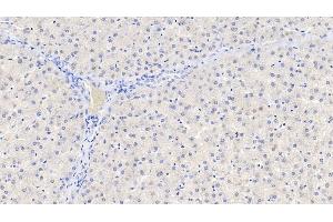 Detection of GDNF in Human Liver Tissue using Polyclonal Antibody to Glial Cell Line Derived Neurotrophic Factor (GDNF) (GDNF Antikörper  (AA 78-211))