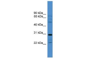 WB Suggested Anti-GJC3 Antibody Titration:  0.