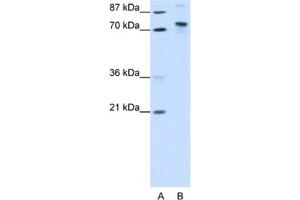 Western Blotting (WB) image for anti-TOX High Mobility Group Box Family Member 4 (TOX4) antibody (ABIN2461858) (TOX4 Antikörper)