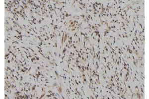 Immunohistochemistry (IHC) image for anti-Leukocyte Immunoglobulin-Like Receptor, Subfamily B (With TM and ITIM Domains), Member 5 (LILRB5) (Internal Region) antibody (ABIN6262970)