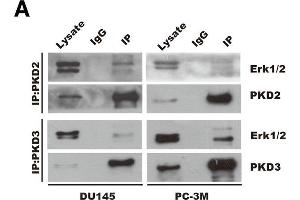 PKD2 and PKD3 promote SCF, CCL5 and CCL11 expression through Erk1/2 signaling pathways.