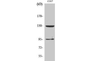 Western Blotting (WB) image for anti-gamma-aminobutyric Acid (GABA) B Receptor, 1 (GABBR1) (C-Term) antibody (ABIN3175200) (GABBR1 Antikörper  (C-Term))