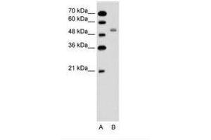 Image no. 2 for anti-Solute Carrier Family 12 (Sodium/potassium/chloride Transporters), Member 1 (SLC12A1) (AA 351-400) antibody (ABIN6736611) (SLC12A1 Antikörper  (AA 351-400))