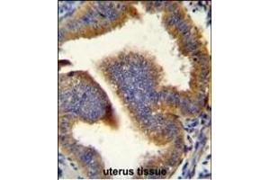 Immunohistochemistry (Paraffin-embedded Sections) (IHC (p)) image for anti-Cyclin B1 (CCNB1) (AA 381-411), (C-Term) antibody (ABIN655054)
