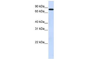 WB Suggested Anti-ZNF287 Antibody Titration:  0. (ZNF287 Antikörper  (N-Term))