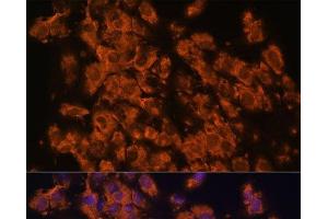 Immunofluorescence analysis of C6 cells using LRRC7 Polyclonal Antibody at dilution of 1:100. (LRRC7 Antikörper)