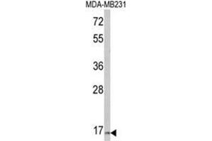 Western blot analysis of TSHB Antibody (Center) in MDA-MB231 cell line lysates (35ug/lane). (TSHB Antikörper  (Middle Region))