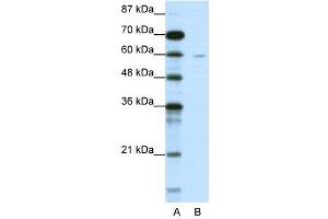 WB Suggested Anti-DCP1A  Antibody Titration: 1. (DCP1A Antikörper  (N-Term))