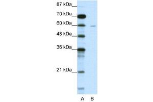 WB Suggested Anti-DCP1A  Antibody Titration: 1. (DCP1A Antikörper  (N-Term))