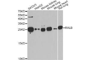 Western blot analysis of extracts of various cell lines, using RALB antibody (ABIN5974057) at 1/1000 dilution.