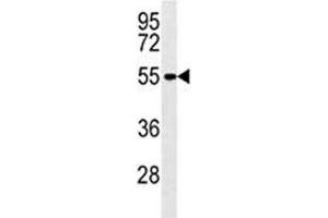 MMP14 antibody western blot analysis in A2058 lysate