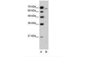 Image no. 1 for anti-Afadin (MLLT4) (AA 152-201) antibody (ABIN204949) (Afadin Antikörper  (AA 152-201))