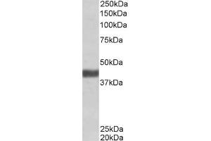 ABIN570946 (1 µg/mL) staining of Human Skeletal Muscle lysate (35 µg protein in RIPA buffer). (FBXO32 Antikörper  (Internal Region))