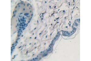 IHC-P analysis of Mouse Tissue, with DAB staining. (Cytokeratin 1 Antikörper  (AA 189-497))