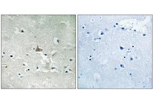 Immunohistochemistry analysis of paraffin-embedded human brain tissue using Trk B (Phospho-Tyr706+Tyr707) antibody. (TRKB Antikörper  (pTyr706, pTyr707))