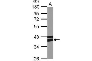 Adiponectin Receptor 1 Antikörper  (C-Term)